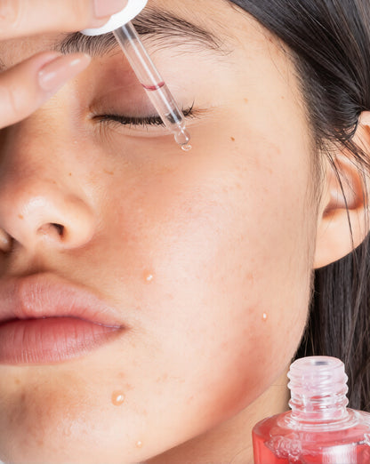 Anua Niacinamide 10% + TXA 4% – Sérum Anti-Manchas